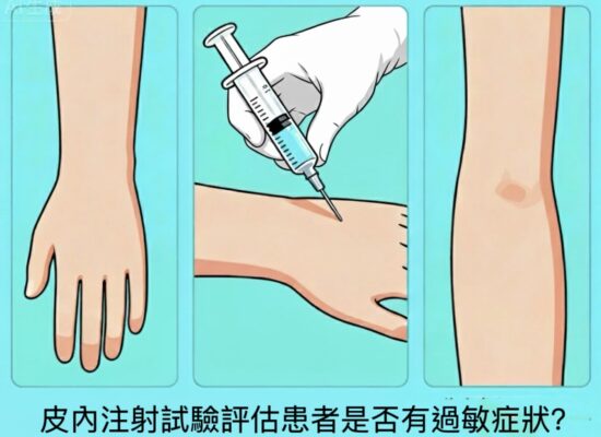 皮膚試驗詳解:塵蟎過敏診斷的金標準